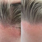 Scalp Essentials & Towel Set