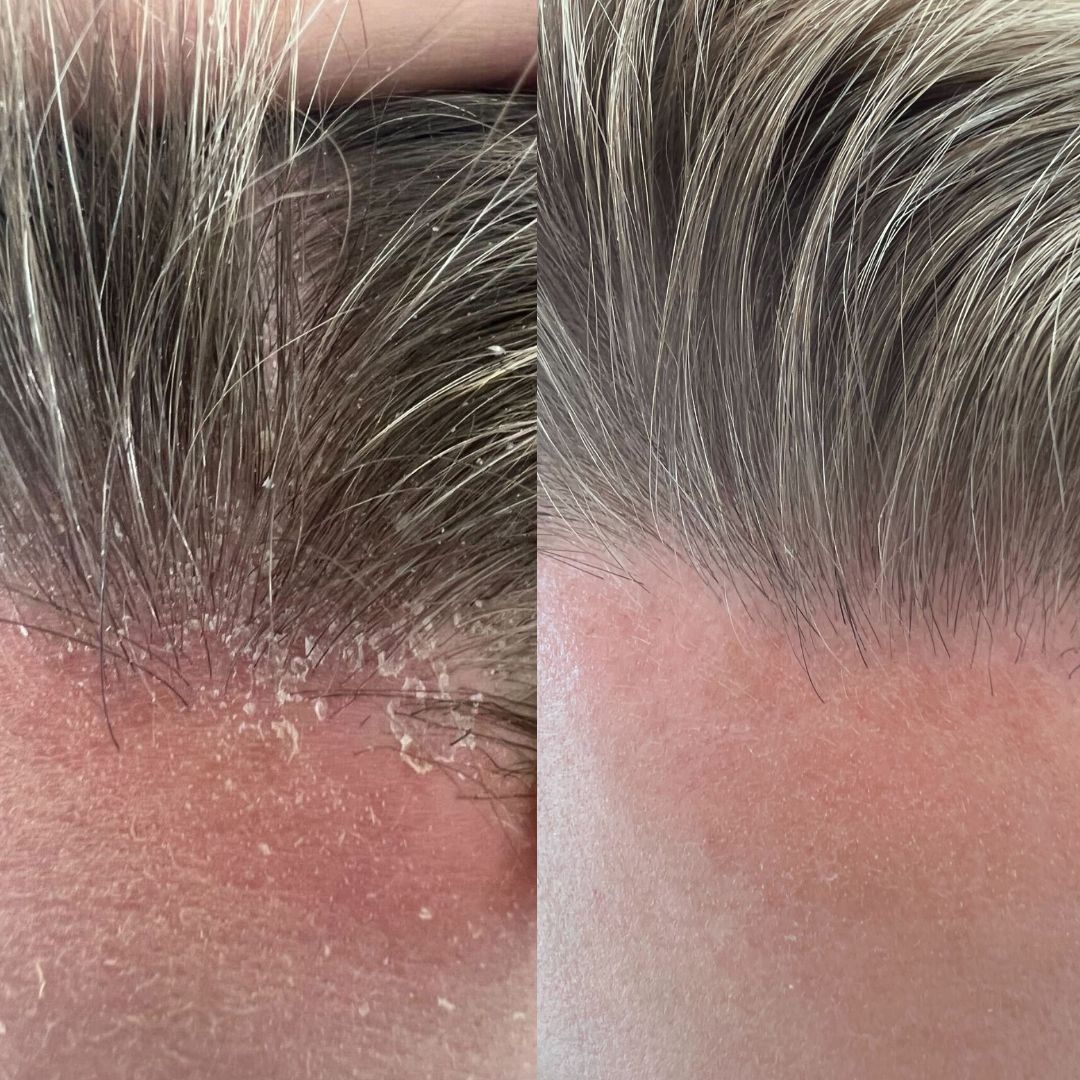 Scalp Care Rituals - 1_1.jpg