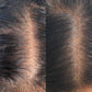 Advanced Scalp Care Starter Set