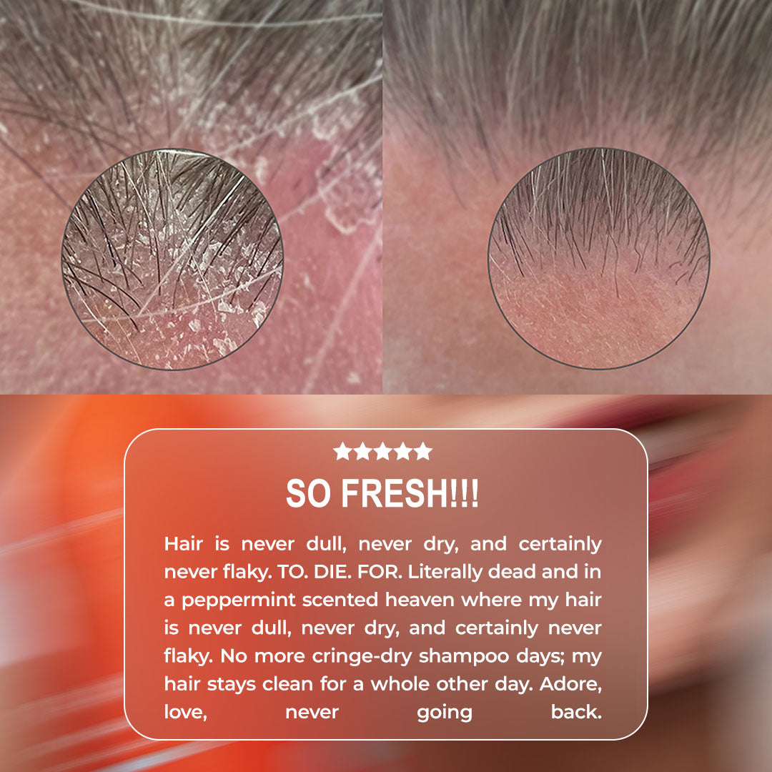 Advanced Flake Free Set