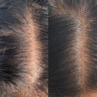 Advanced Scalp Care Starter Set